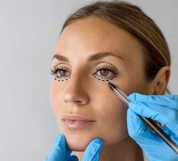 Expert Blepharoplasty Consultation Services Available in Essex Clinics
